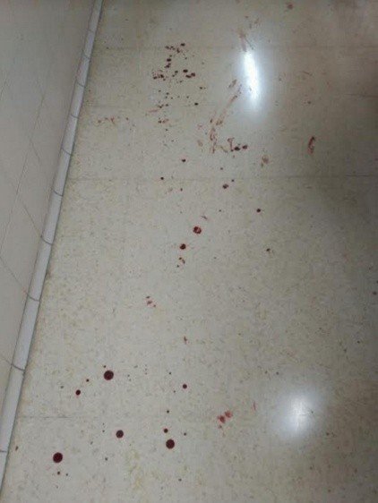 Sangre en los pasillos del CIE de Murcia.