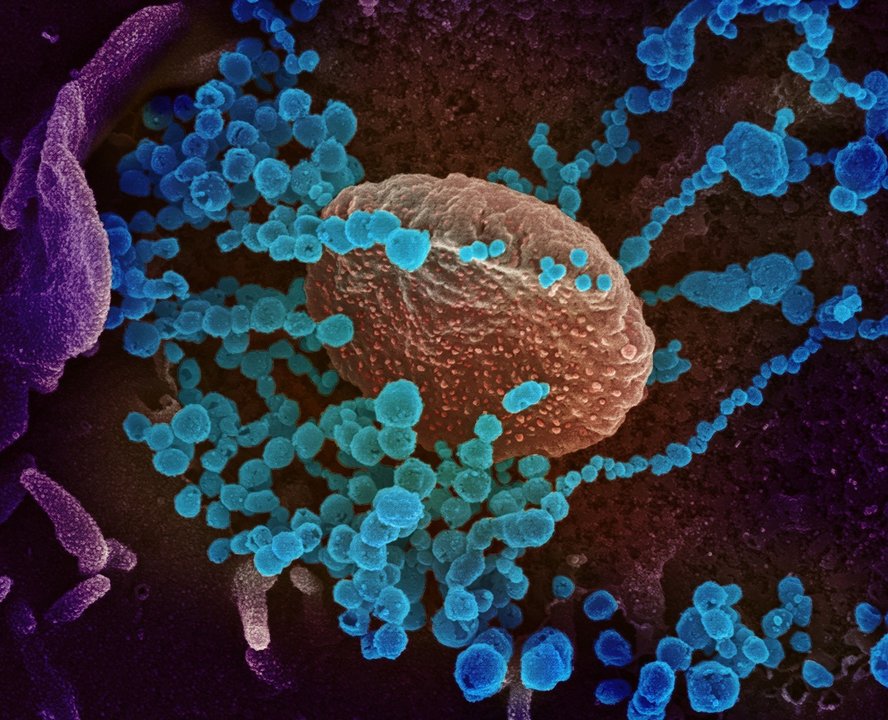 imagen de microscopio electrónico del Instituto estadounidense de Alergia y Enfermedades Infecciosas (NIAID), coloreada digitalmente, muestra el SARS-CoV-2
13/11/2021