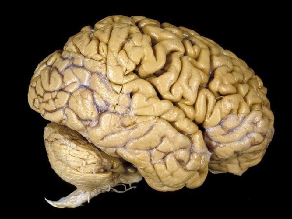 El cerebro humano es una masa de 1,4 kg compuesta por grasas y tejidos gelatinosos y es la más compleja de todas las estructuras vivas conocidas. Hasta un billón de células nerviosas trabajan unidas para coordinar las actividades físicas y los procesos mentales que distinguen a los seres humanos de otras especies.