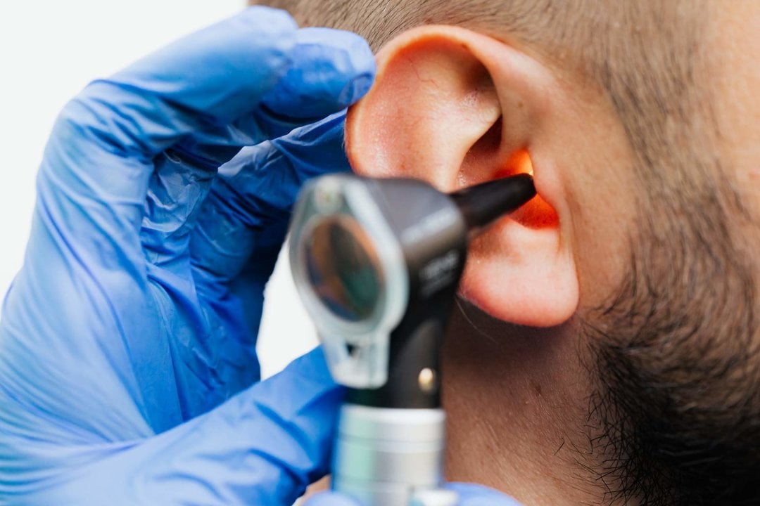 Remedios caseros para aliviar el dolor de oído: Alivios naturales para el malestar auditivo.