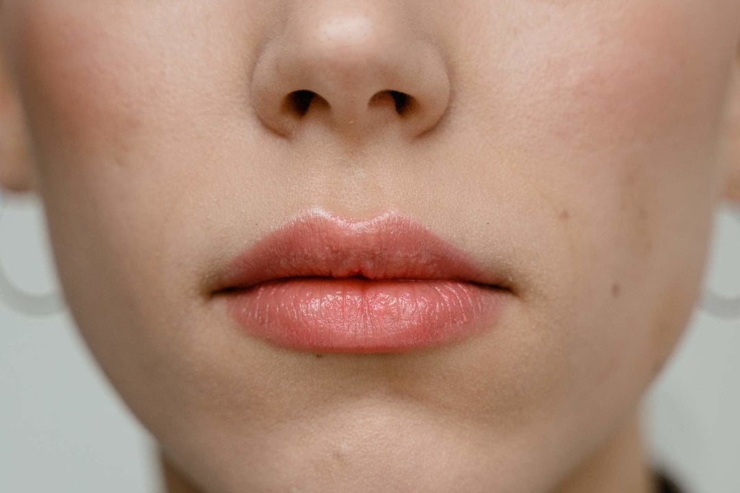 7 remedios caseros para eliminar un herpes labial.