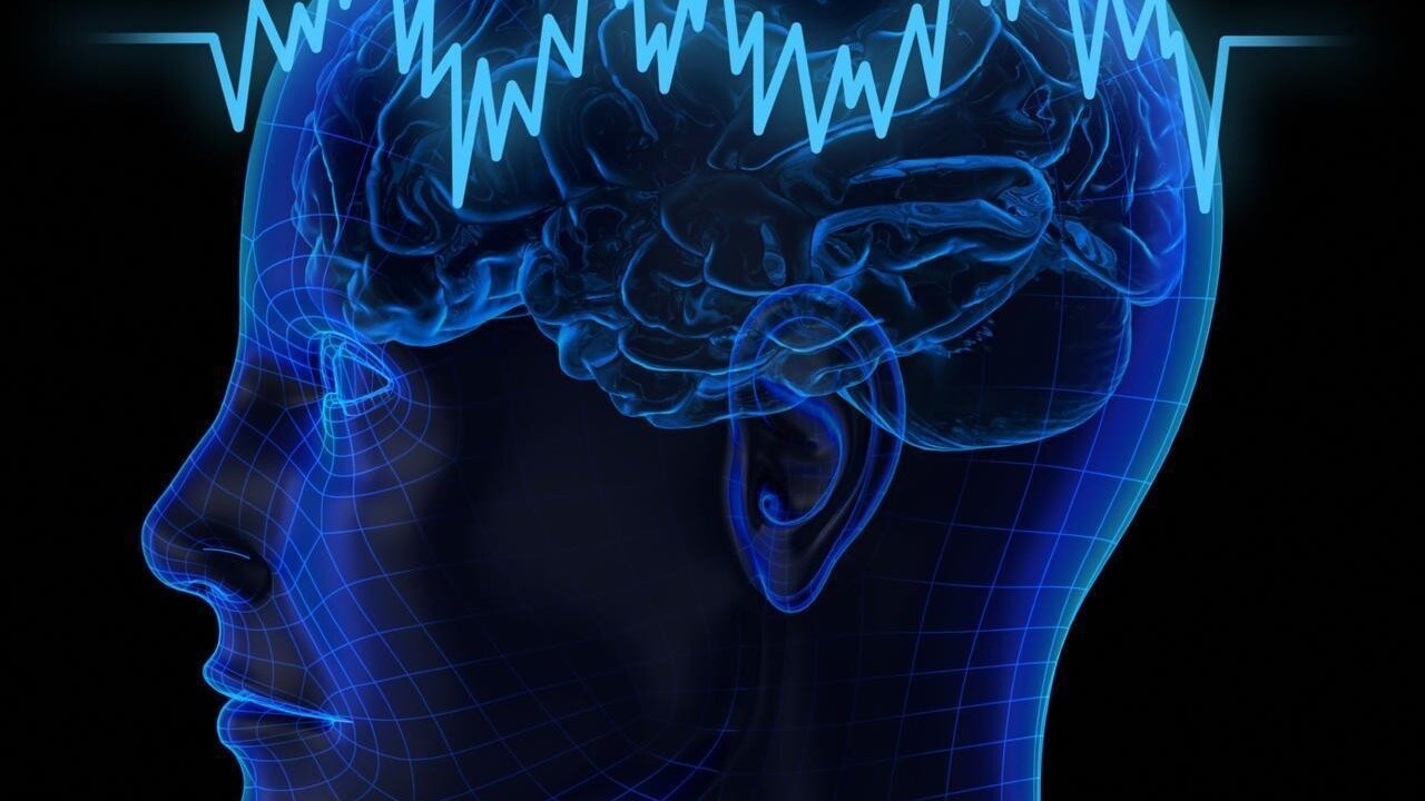 Actividad cerebral. 