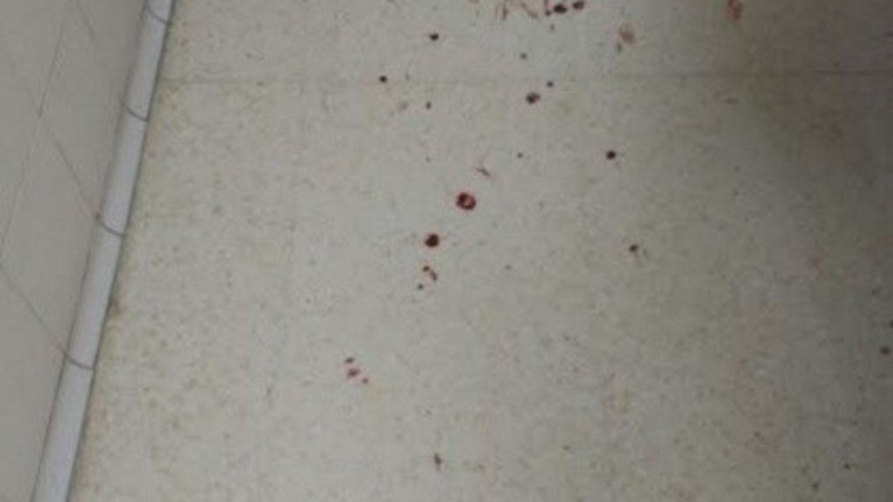 Sangre en los pasillos del CIE de Murcia.