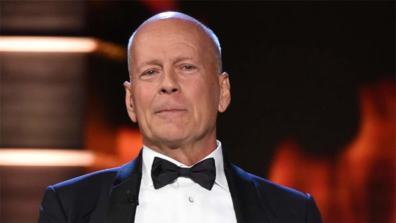 El cambio de Bruce Willis: Antes y después. Fuente | Ciudad Magazine.