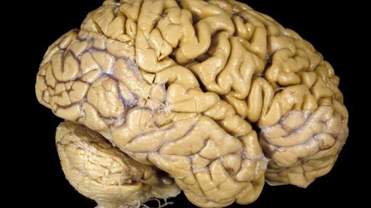 El cerebro humano es una masa de 1,4 kg compuesta por grasas y tejidos gelatinosos y es la más compleja de todas las estructuras vivas conocidas. Hasta un billón de células nerviosas trabajan unidas para coordinar las actividades físicas y los procesos mentales que distinguen a los seres humanos de otras especies.
